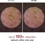 Dr.Melaxin Peel Shot Exfoliating White Rice Ampoule 80ml - Image 4